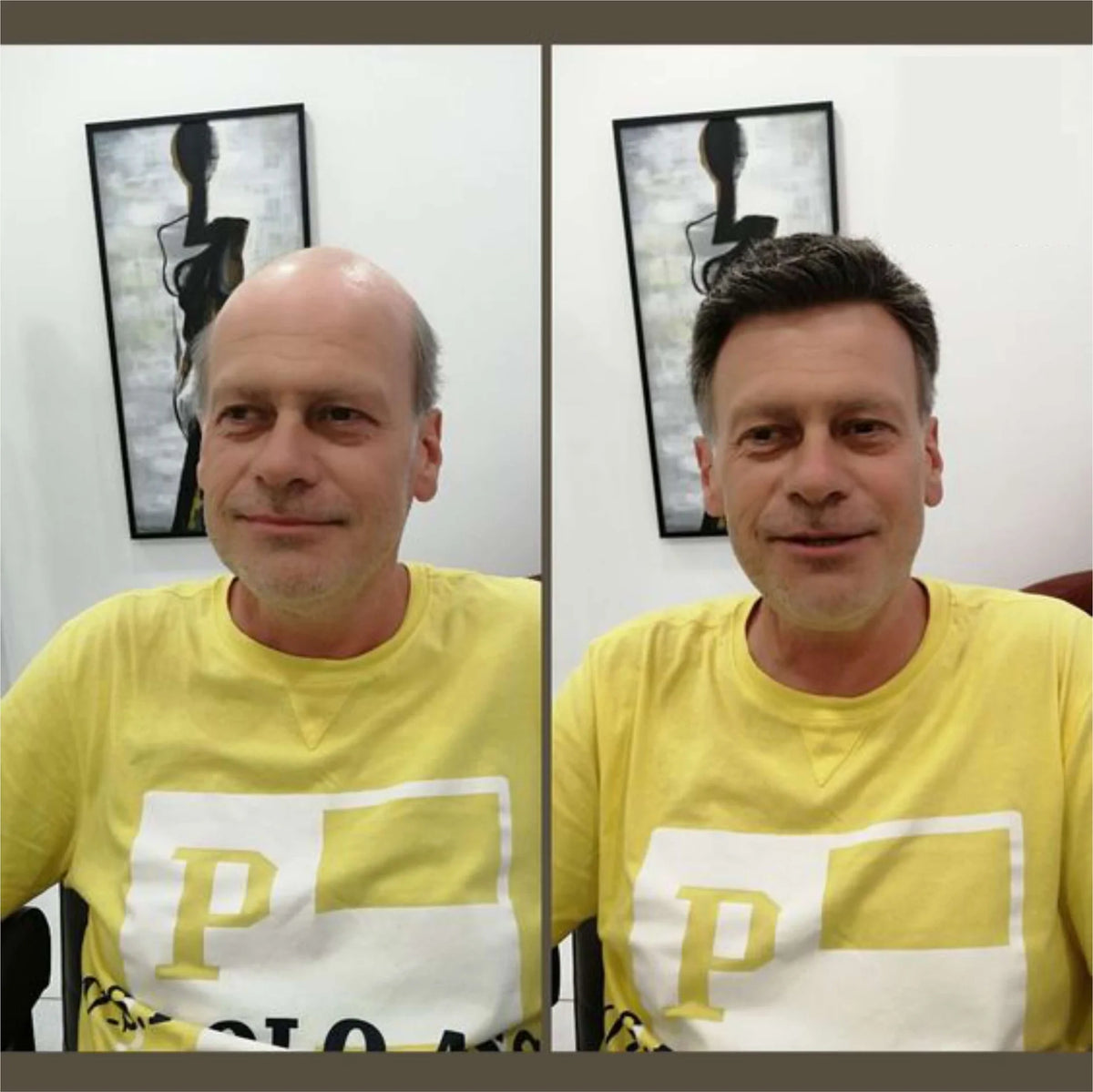 Full Swiss Lace: Hair System for Bald Men  Full Swiss Lace Base | Best for Active Lifestyle