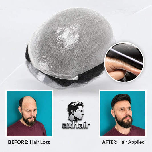 V-loop bio skin hair system dome base with inset hairline detail