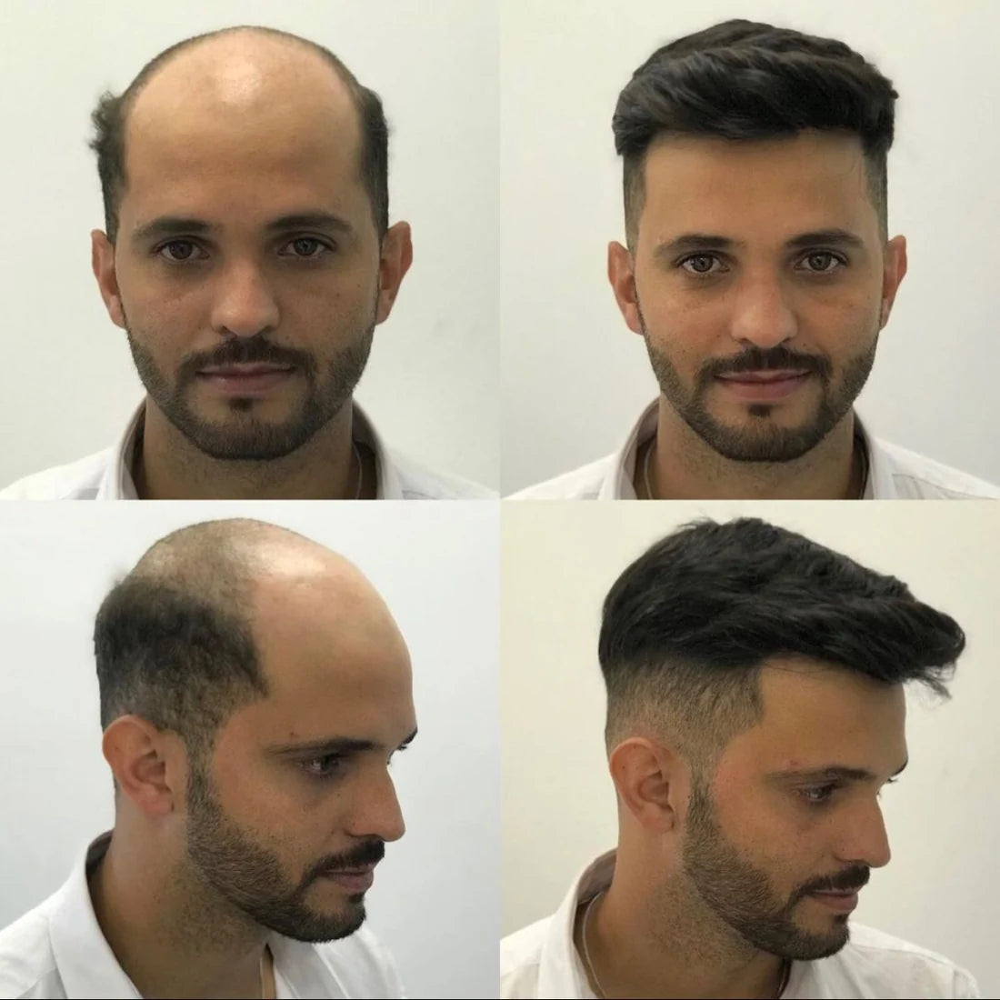 0.10-0.12mm Double Knots Full Skin Base  Men's Hair Unit  Men's Hairstyle for Thin Hair