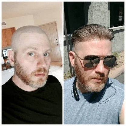 Q6 base Men's Non Surgical Hair Replacement  Swiss Lace With Skin Poly Back and Middle Best for Gym（Buy One, Get One Free ）