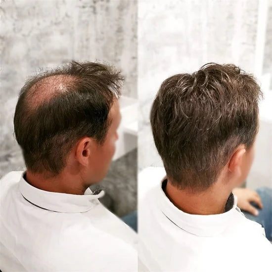 0.10-0.12mm Double Knots Full Skin Base  Men's Hair Unit  Men's Hairstyle for Thin Hair