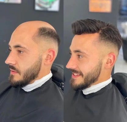 Full Germany LaceA durable, stable, and natural-looking lace base with a 120%–130% high-density hair option for a fuller hairstyle