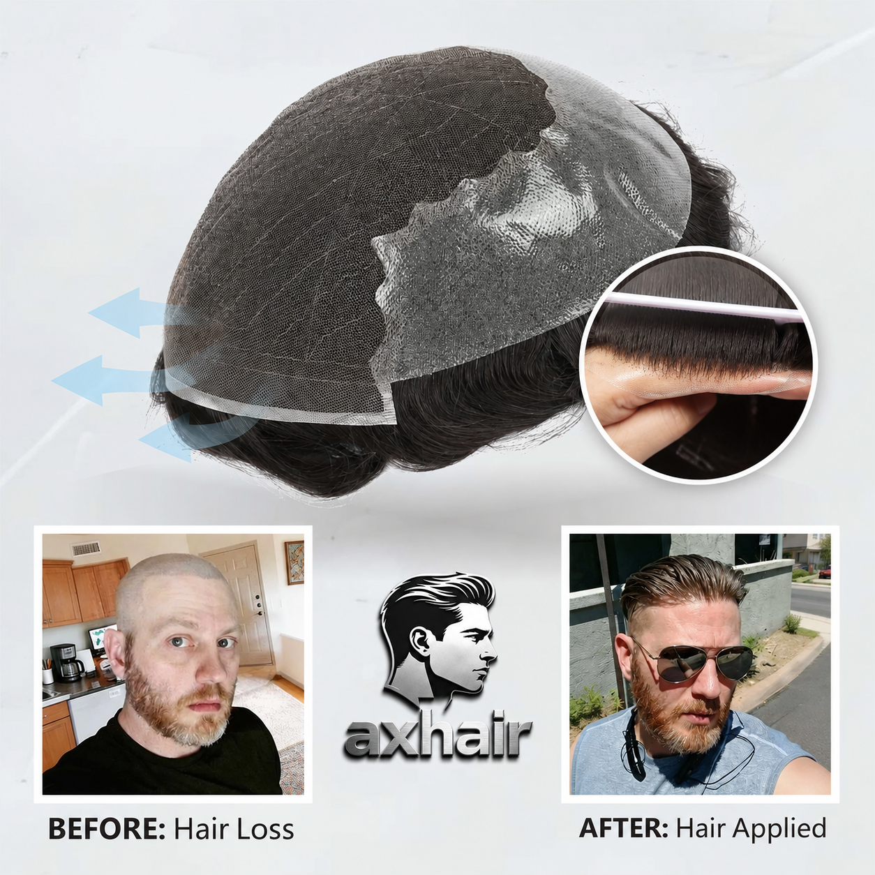 Q6 base Men's Non Surgical Hair Replacement  Swiss Lace With Skin Poly Back and Middle Best for Gym
