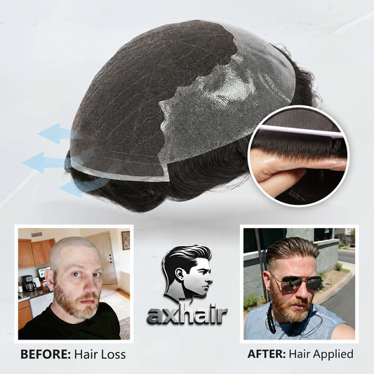 Men's non-surgical hair replacement base with Swiss lace and skin-poly backing, hairline detail