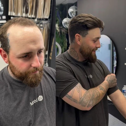 Q6 base Men's Non Surgical Hair Replacement  Swiss Lace With Skin Poly Back and Middle Best for Gym（Buy One, Get One Free ）