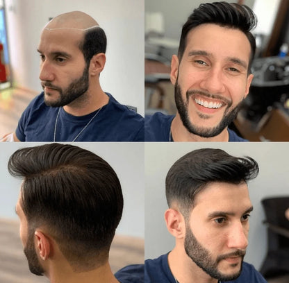 Full Germany LaceA durable, stable, and natural-looking lace base with a 120%–130% high-density hair option for a fuller hairstyle