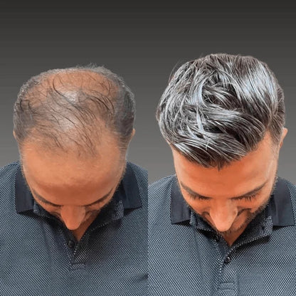 Fine Mono Hairpiece for Men With NPU Gauze Crown & Perimeter and Skin Front